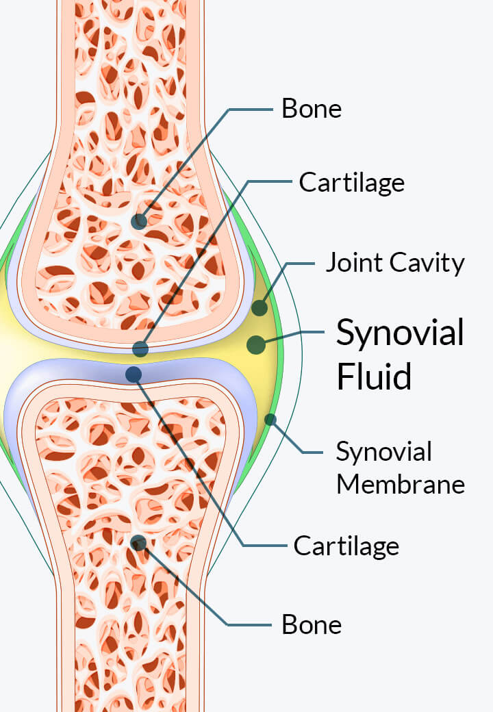 Anatomical cross-section diagram of a joint showing bone, cartilage, joint cavity, synovial fluid, and synovial membrane