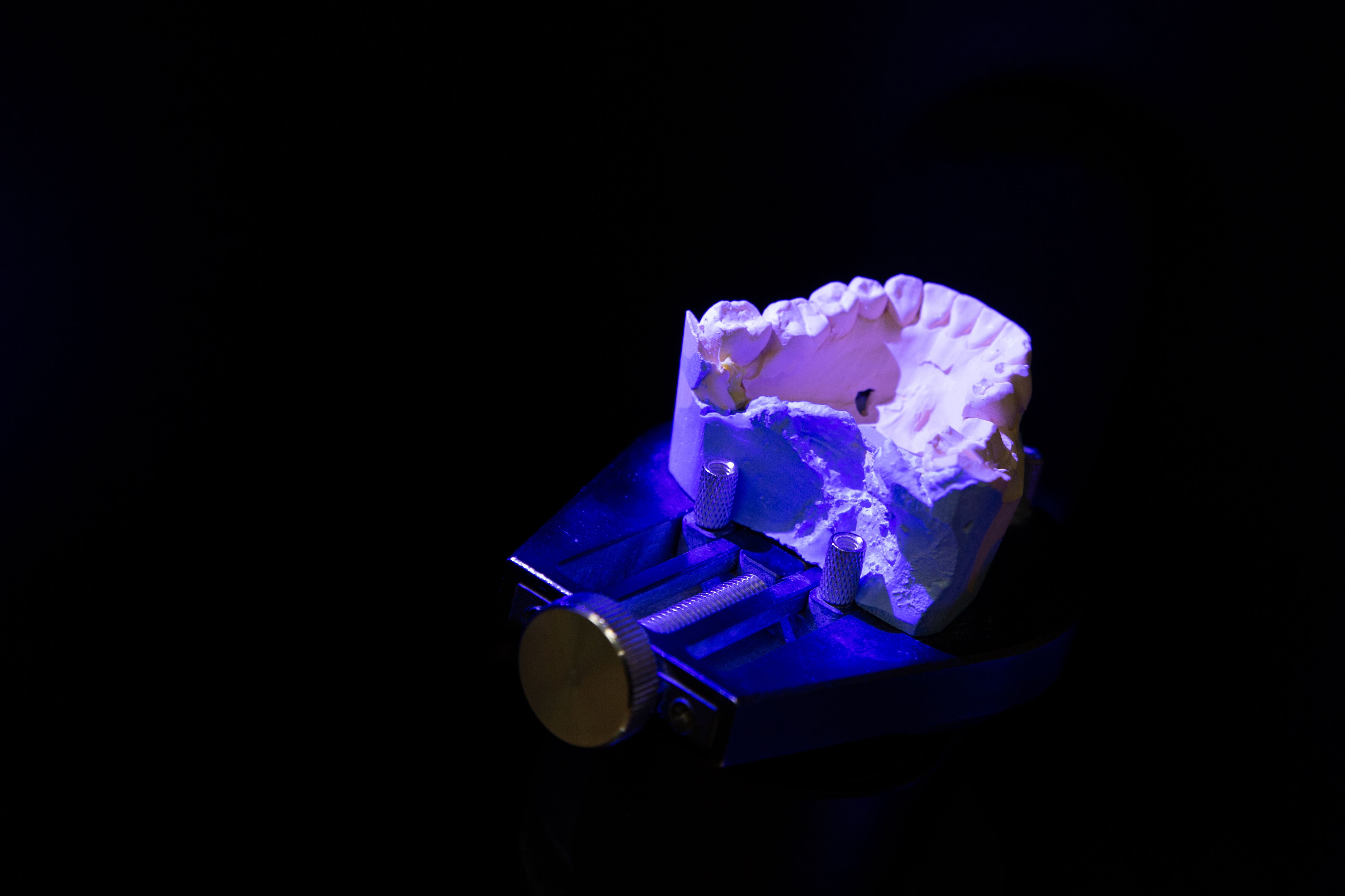 Modelo dental con tecnología avanzada