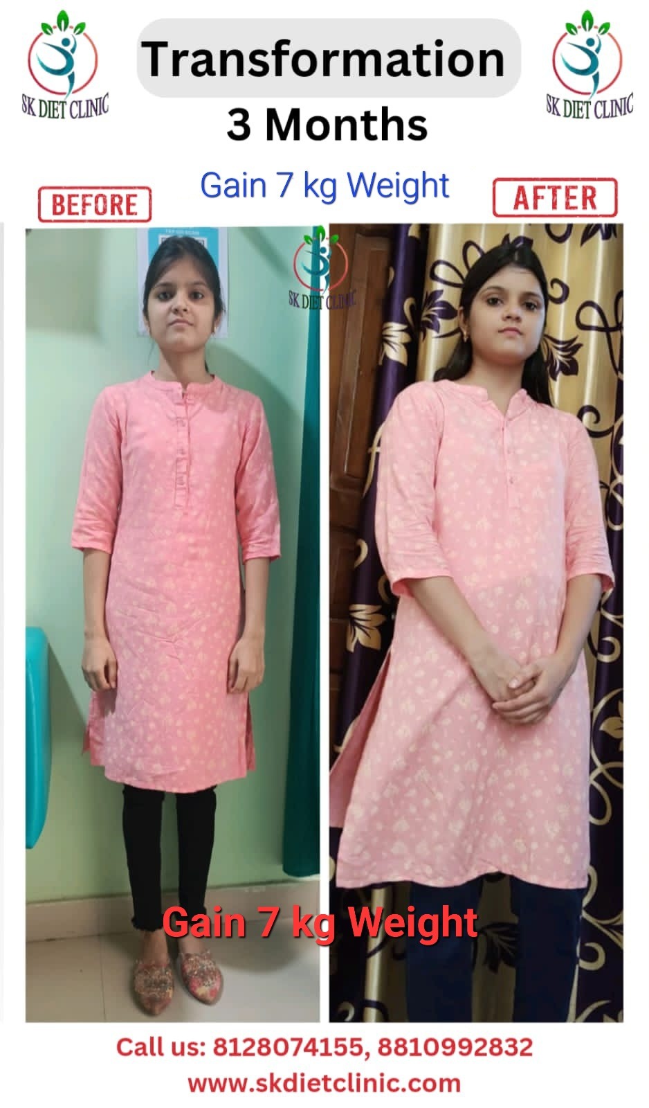 3 Months Gain 7kg Weight transformation at SK Diet Clinic