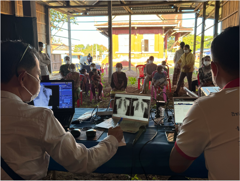 Active TB screening in community