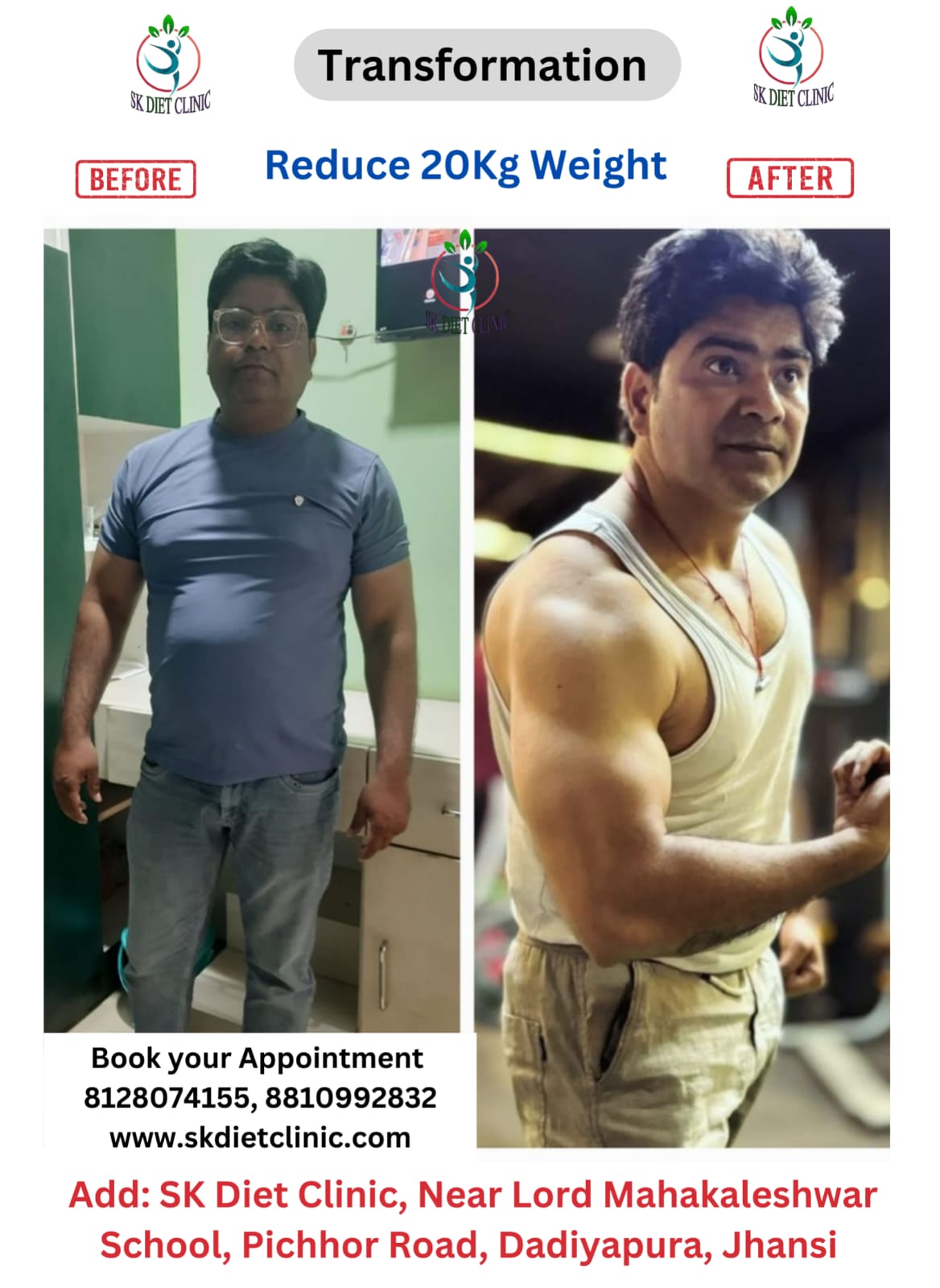 Massive weight loss transformation reducing 20kg at SK Diet Clinic