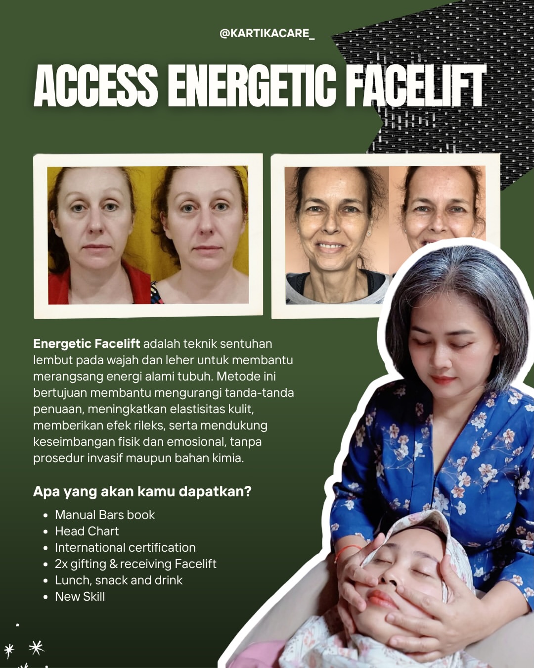 Access Energetic Facelift - Teknik sentuhan lembut pada wajah
