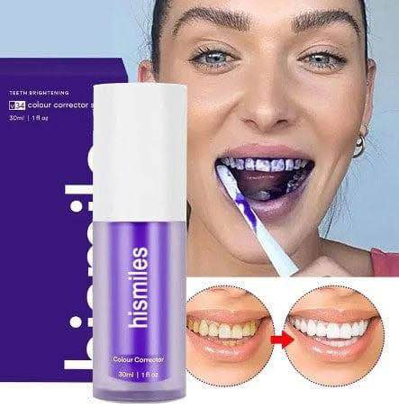 HiSmile V34 প্রোডাক্টের বোতল ও প্যাকেজিং, সাথে দাঁত সাদা করার আগে এবং পরের ফলাফলের তুলনা
